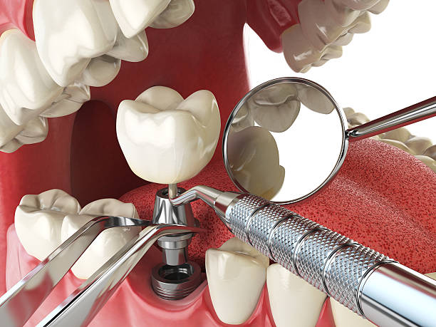 Best After-Hours Emergency Dentist in Carlyle, IL